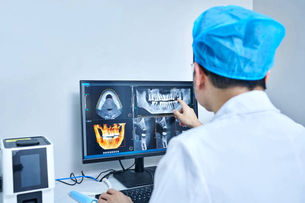 Best Knocked-Out Tooth (Avulsed Tooth) Treatment in University Of Lifornia Davis, CA